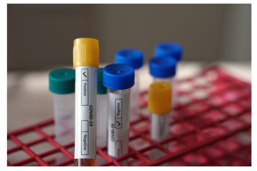 Istituto Superiore Sanità: questionario per valutare l’impiego dei test salivari nelle scuole.